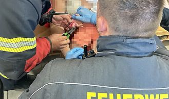 Vorschaubild: Finger steckt in Spielzeug fest